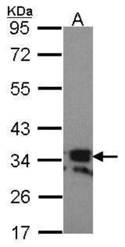 Invitrogen CD254 (RANK Ligand) Polyclonal Antibody 100 &mu;L; Unconjugated:Antibodies,
