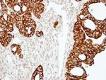 Thumbnail_RAP2C Polyclonal Antibody, Invitrogen 100 &mu;L; Unconjugated:Antibodies,