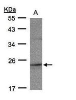 Thumbnail_RAP2C Polyclonal Antibody, Invitrogen 100 &mu;L; Unconjugated:Antibodies,