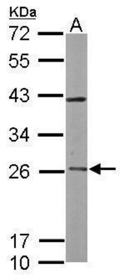 Invitrogen RAB3C Polyclonal Antibody 100 &mu;L; Unconjugated:Antibodies,