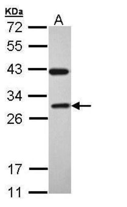 Invitrogen RAB3C Polyclonal Antibody 100 &mu;L; Unconjugated:Antibodies,