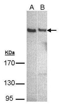 Invitrogen PLCH1 Isoform B Polyclonal Antibody 100 &mu;L; Unconjugated:Antibodies,