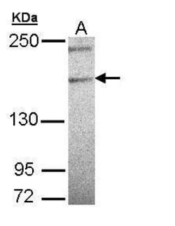 Invitrogen PLCH1 Isoform B Polyclonal Antibody 100 &mu;L; Unconjugated:Antibodies,