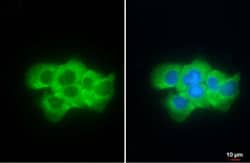 Invitrogen Fibrinogen gamma Polyclonal Antibody 100 &mu;L; Unconjugated:Antibodies,
