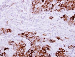 Invitrogen Fibrinogen gamma Polyclonal Antibody 100 &mu;L; Unconjugated:Antibodies,