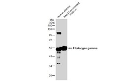 Invitrogen Fibrinogen gamma Polyclonal Antibody 100 &mu;L; Unconjugated:Antibodies,
