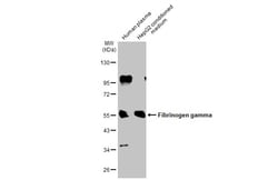 Invitrogen Fibrinogen gamma Polyclonal Antibody 100 &mu;L; Unconjugated:Antibodies,