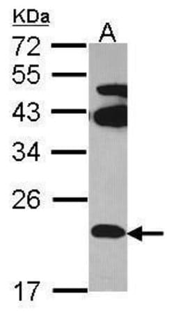 Invitrogen FAM18B Polyclonal Antibody 100 &mu;L | Buy Online | Invitrogen&trade; | Fisher Scientific