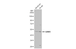 Invitrogen Kir3.1 (KCNJ3) Polyclonal Antibody 100 &mu;L | Buy Online | Invitrogen&trade; | Fisher Scientific