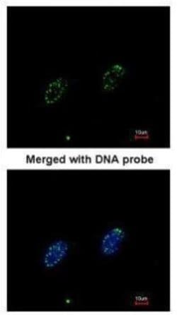 Invitrogen RPA70 Polyclonal Antibody 100 &mu;L; Unconjugated:Antibodies,
