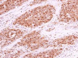 Invitrogen RPA70 Polyclonal Antibody 100 &mu;L; Unconjugated:Antibodies,
