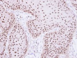 Invitrogen RPA70 Polyclonal Antibody 100 &mu;L; Unconjugated:Antibodies,