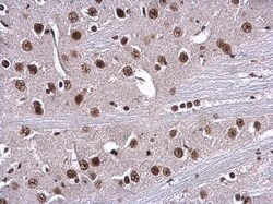 Invitrogen RPA70 Polyclonal Antibody 100 &mu;L; Unconjugated:Antibodies,