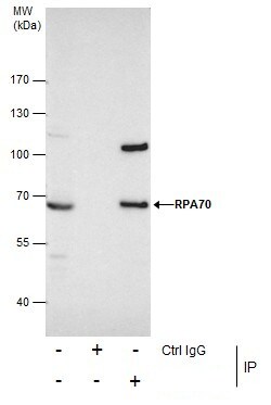 Invitrogen RPA70 Polyclonal Antibody 100 &mu;L; Unconjugated:Antibodies,