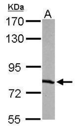Invitrogen RPA70 Polyclonal Antibody 100 &mu;L; Unconjugated:Antibodies,