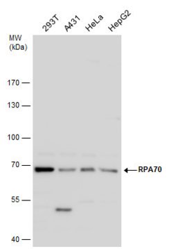Invitrogen RPA70 Polyclonal Antibody 100 &mu;L; Unconjugated:Antibodies,