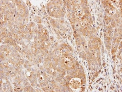 Invitrogen PDE9A Polyclonal Antibody 100 &mu;L; Unconjugated:Antibodies,