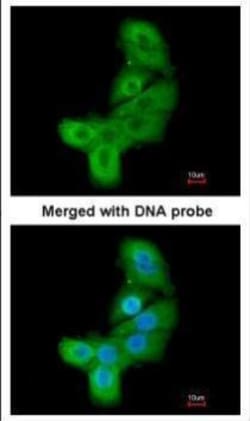 Invitrogen LIMK2 Polyclonal Antibody 100 &mu;L; Unconjugated:Antibodies,