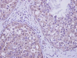 Invitrogen LIMK2 Polyclonal Antibody 100 &mu;L; Unconjugated:Antibodies,