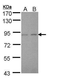 Invitrogen LIMK2 Polyclonal Antibody 100 &mu;L; Unconjugated:Antibodies,