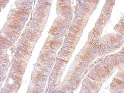 Invitrogen B3GNT3 Polyclonal Antibody 100 &mu;L | Buy Online | Invitrogen&trade; | Fisher Scientific