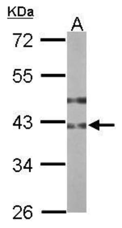 Invitrogen B3GNT3 Polyclonal Antibody 100 &mu;L | Buy Online | Invitrogen&trade; | Fisher Scientific