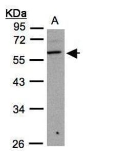 Invitrogen B3GNT3 Polyclonal Antibody 100 &mu;L | Buy Online | Invitrogen&trade; | Fisher Scientific