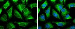 Invitrogen SLC25A13 Polyclonal Antibody 100 &mu;L; Unconjugated:Antibodies,
