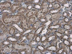 Invitrogen SLC25A13 Polyclonal Antibody 100 &mu;L; Unconjugated:Antibodies,