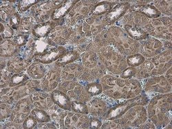 Invitrogen SLC25A13 Polyclonal Antibody 100 &mu;L; Unconjugated:Antibodies,
