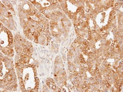 Invitrogen SLC25A13 Polyclonal Antibody 100 &mu;L; Unconjugated:Antibodies,