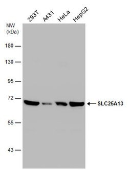 Invitrogen SLC25A13 Polyclonal Antibody 100 &mu;L; Unconjugated:Antibodies,