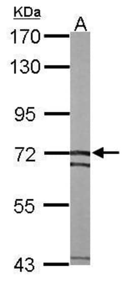 Invitrogen SLC25A13 Polyclonal Antibody 100 &mu;L; Unconjugated:Antibodies,