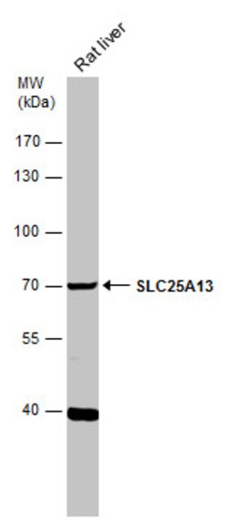 Invitrogen SLC25A13 Polyclonal Antibody 100 &mu;L; Unconjugated:Antibodies,