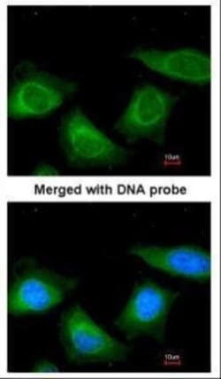 Invitrogen SERPINA7 Polyclonal Antibody 100 &mu;L; Unconjugated:Anticuerpos