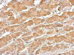 Invitrogen SERPINA7 Polyclonal Antibody 100 &mu;L; Unconjugated:Anticuerpos