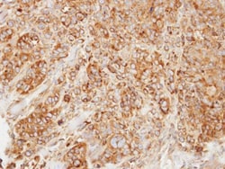 Invitrogen HMGCL Polyclonal Antibody 100 μL; Unconjugated:Antibodies,