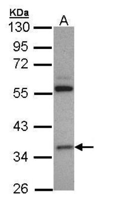 Invitrogen HMGCL Polyclonal Antibody 100 μL; Unconjugated:Antibodies,