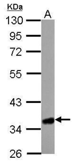 Invitrogen HMGCL Polyclonal Antibody 100 μL; Unconjugated:Antibodies,
