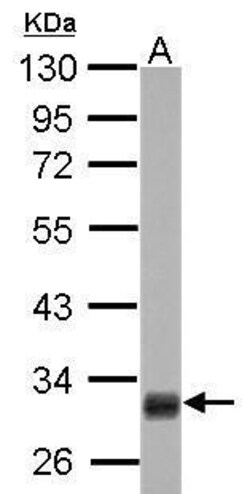 Invitrogen HMGCL Polyclonal Antibody 100 μL; Unconjugated:Antibodies,