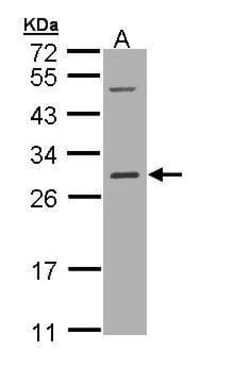 Invitrogen RALB Polyclonal Antibody 100 &mu;L; Unconjugated:Antibodies,