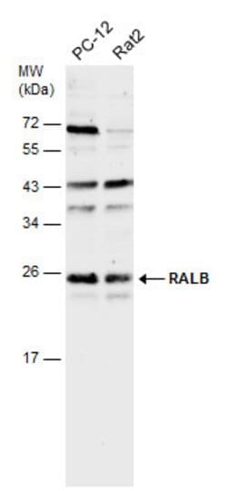 Invitrogen RALB Polyclonal Antibody 100 &mu;L; Unconjugated:Antibodies,