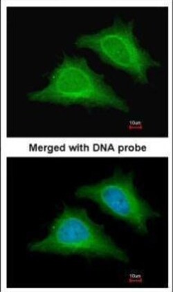 Invitrogen AMPK gamma-2 Polyclonal Antibody 100 &mu;L; Unconjugated:Antibodies,