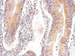 Invitrogen AMPK gamma-2 Polyclonal Antibody 100 &mu;L; Unconjugated:Antibodies,