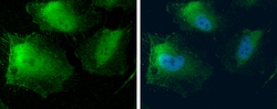 Invitrogen MTAP Polyclonal Antibody 100 μL; Unconjugated:Antibodies,
