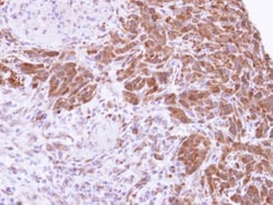 Invitrogen MTAP Polyclonal Antibody 100 μL; Unconjugated:Antibodies,