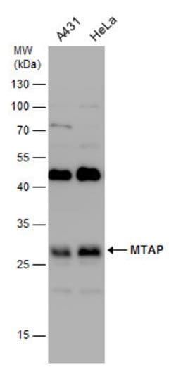 Invitrogen MTAP Polyclonal Antibody 100 μL; Unconjugated:Antibodies,