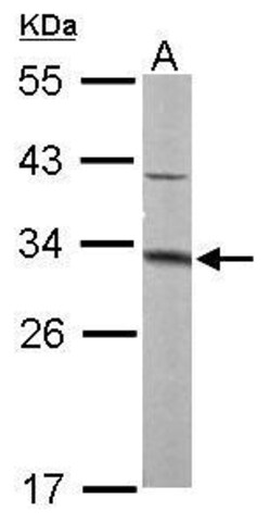 Invitrogen MTAP Polyclonal Antibody 100 μL; Unconjugated:Antibodies,