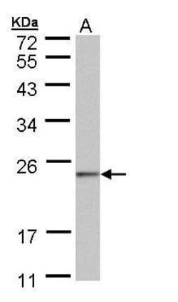 Invitrogen NDUFAF4 Polyclonal Antibody 100 &mu;L; Unconjugated:Antibodies,