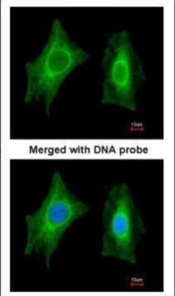 Invitrogen PSPH Polyclonal Antibody 100 &mu;L; Unconjugated:Anticorps,